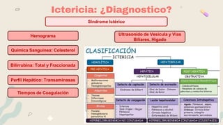Ictericia: ¿Diagnostico?
Hemograma
Bilirrubina: Total y Fraccionada
Perfil Hepático: Transaminasas
Tiempos de Coagulación
Química Sanguínea: Colesterol
Ultrasonido de Vesícula y Vías
Biliares, Hígado
Sindrome Ictérico
 