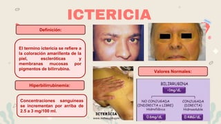 ICTERICIA
El termino ictericia se refiere a
la coloración amarillenta de la
piel, escleróticas y
membranas mucosas por
pigmentos de bilirrubina.
Concentraciones sanguíneas
se incrementan por arriba de
2.5 a 3 mg/100 ml.
Definición:
Hiperbilirrubinemia:
Valores Normales:
 