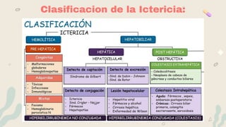 Clasificacion de la Ictericia:
 