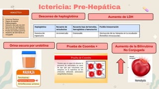 Ictericia: Pre-Hepática
Aumento de LDH
Orina oscura por urobilina
Descenso de haptoglobina
Aumento de la Bilirrubina
No Conjugada
Prueba de Coombs +
 