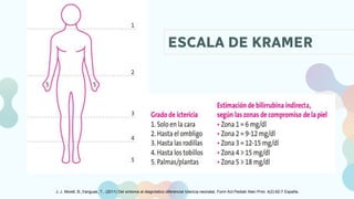 Kramer Test ICTERICIA NEONATAL - GUIA CLINICA - NEONATOLOGÍA | PPTX