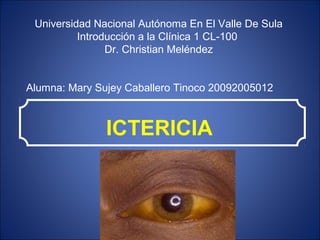 ICTERICIA
Universidad Nacional Autónoma En El Valle De Sula
Introducción a la Clínica 1 CL-100
Dr. Christian Meléndez
Alumna: Mary Sujey Caballero Tinoco 20092005012
 