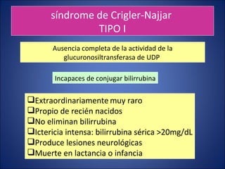 síndrome de Crigler-Najjar  TIPO I <ul><li>Extraordinariamente   muy raro </li></ul><ul><li>Propio de recién nacidos </li>...