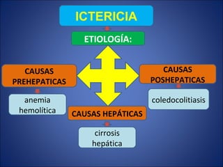 ICTERICIA ETIOLOGÍA : CAUSAS HEPÁTICAS CAUSAS PREHEPATICAS CAUSAS POSHEPATICAS coledocolitiasis cirrosis hepática anemia h...