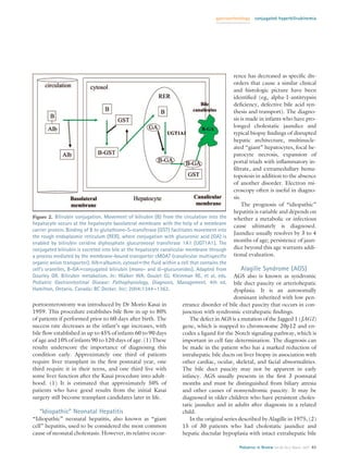 gastroenterology   conjugated hyperbilirubinemia




                                                                                             rence has decreased as speciﬁc dis-
                                                                                             orders that cause a similar clinical
                                                                                             and histologic picture have been
                                                                                             identiﬁed (eg, alpha-1-antitrypsin
                                                                                             deﬁciency, defective bile acid syn-
                                                                                             thesis and transport). The diagno-
                                                                                             sis is made in infants who have pro-
                                                                                             longed cholestatic jaundice and
                                                                                             typical biopsy ﬁndings of disrupted
                                                                                             hepatic architecture, multinucle-
                                                                                             ated “giant” hepatocytes, focal he-
                                                                                             patocyte necrosis, expansion of
                                                                                             portal triads with inﬂammatory in-
                                                                                             ﬁltrate, and extramedullary hema-
                                                                                             topoiesis in addition to the absence
                                                                                             of another disorder. Electron mi-
                                                                                             croscopy often is useful in diagno-
                                                                                             sis.
                                                                                                  The prognosis of “idiopathic”
                                                                                             hepatitis is variable and depends on
Figure 2. Bilirubin conjugation. Movement of bilirubin (B) from the circulation into the     whether a metabolic or infectious
hepatocyte occurs at the hepatocyte basolateral membrane with the help of a membrane
                                                                                             cause ultimately is diagnosed.
carrier protein. Binding of B to glutathione-S-transferase (GST) facilitates movement into
                                                                                             Jaundice usually resolves by 3 to 4
the rough endoplasmic reticulum (RER), where conjugation with glucuronic acid (GA) is
enabled by bilirubin ceridine diphosphate glucuronosyl transferase 1A1 (UGT1A1). The         months of age; persistence of jaun-
conjugated bilirubin is excreted into bile at the hepatocyte canalicular membrane through    dice beyond this age warrants addi-
a process mediated by the membrane-bound transporter cMOAT (canalicular multispeciﬁc         tional evaluation.
organic anion transporter). Alb albumin, cytosol the ﬂuid within a cell that contains the
cell’s oranelles, B-GA conjugated bilirubin (mono- and di-glucuronides). Adapted from           Alagille Syndrome (AGS)
Gourley GR. Bilirubin metabolism. In: Walker WA, Goulet OJ, Kleinman RE, et al, eds.         AGS also is known as syndromic
Pediatric Gastrointestinal Disease: Pathophysiology, Diagnosis, Management. 4th ed.          bile duct paucity or arteriohepatic
Hamilton, Ontario, Canada: BC Decker, Inc; 2004:1344 –1362.                                  dysplasia. It is an autosomally
                                                                                             dominant inherited with low pen-
portoenterostomy was introduced by Dr Morio Kasai in                 etrance disorder of bile duct paucity that occurs in con-
1959. This procedure establishes bile ﬂow in up to 80%               junction with syndromic extrahepatic ﬁndings.
of patients if performed prior to 60 days after birth. The               The defect in AGS is a mutation of the Jagged 1 (JAG1)
success rate decreases as the infant’s age increases, with           gene, which is mapped to chromosome 20p12 and en-
bile ﬂow established in up to 45% of infants 60 to 90 days           codes a ligand for the Notch signaling pathway, which is
of age and 10% of infants 90 to 120 days of age. (1) These           important in cell fate determination. The diagnosis can
results underscore the importance of diagnosing this                 be made in the patient who has a marked reduction of
condition early. Approximately one third of patients                 intrahepatic bile ducts on liver biopsy in association with
require liver transplant in the ﬁrst postnatal year, one             other cardiac, ocular, skeletal, and facial abnormalities.
third require it in their teens, and one third live with             The bile duct paucity may not be apparent in early
some liver function after the Kasai procedure into adult-            infancy. AGS usually presents in the ﬁrst 3 postnatal
hood. (1) It is estimated that approximately 50% of                  months and must be distinguished from biliary atresia
patients who have good results from the initial Kasai                and other causes of nonsyndromic paucity. It may be
surgery still become transplant candidates later in life.            diagnosed in older children who have persistent choles-
                                                                     tatic jaundice and in adults after diagnosis in a related
   “Idiopathic” Neonatal Hepatitis                                   child.
“Idiopathic” neonatal hepatitis, also known as “giant                    In the original series described by Alagille in 1975, (2)
cell” hepatitis, used to be considered the most common               15 of 30 patients who had cholestatic jaundice and
cause of neonatal cholestasis. However, its relative occur-          hepatic ductular hypoplasia with intact extrahepatic bile

                                                                                               Pediatrics in Review Vol.28 No.3 March 2007 85
 