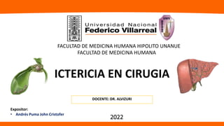 FACULTAD DE MEDICINA HUMANA HIPOLITO UNANUE
FACULTAD DE MEDICINA HUMANA
ICTERICIA EN CIRUGIA
DOCENTE: DR. ALVIZURI
Expositor:
• Andrés Puma John Cristofer
2022
 