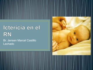 Br. Jensen Marcel Castillo
Lechado
 