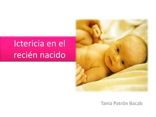 Ictericia en el
recién nacido
Tania Patrón Bacab
 