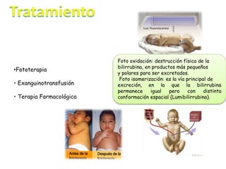 •Fototerapia
• Exanguinotransfusión
• Terapia Farmacológica
Foto oxidación: destrucción física de la
bilirrubina, en productos más pequeños
y polares para ser excretados.
Foto isomerización: es la vía principal de
excreción, en la que la bilirrubina
permanece igual pero con distinta
conformación espacial (Lumibilirrubina).
 