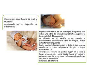 Coloración amarillenta de piel y
mucosas
ocasionada por el depósito de
bilirrubina.
Hiperbilirrubinemia es un concepto bioquímico que
indica una cifra de bilirrubina plasmática superior a
la normalidad. Clínicamente
se observa en el recién nacido cuando la
bilirrubinemia sobrepasa la cifra de 5 mg/dL. Puede
detectarse blanqueando
la piel mediante la presión con el dedo, lo que pone de
manifiesto el color subyacente de piel y tejido
subcutáneo. La
ictericia se observa en primer lugar en la cara y
luego progresa de forma caudal hacia el tronco y
extremidades. La progresión cefalocaudal puede ser
útil para la valoración
del grado de ictericia.
 