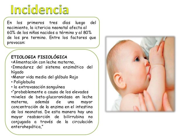 Ictericia neonatal