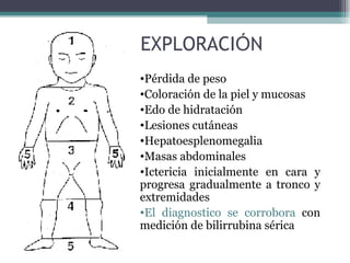 Pérdida de peso  Coloraci ó n de la piel y mucosas  Edo de hidrataci ó n Lesiones cut á neas  Hepatoesplenomegalia Masas abdominales Ictericia inicialmente en cara y progresa gradualmente a tronco y extremidades El diagnostico se corrobora  con medici ó n de bilirrubina s é rica EXPLORACI Ó N 