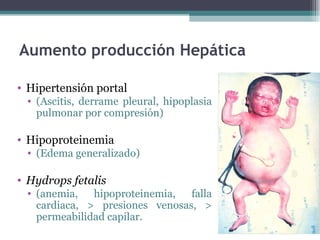 Aumento producción Hepática Hipertensión portal  (Ascitis, derrame pleural, hipoplasia pulmonar por compresión) Hipoproteinemia  (Edema generalizado) Hydrops   fetalis   (anemia, hipoproteinemia, falla cardiaca, > presiones venosas, > permeabilidad capilar. 