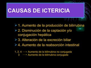 CAUSAS DE ICTERICIA 1. Aumento de la producción de bilirrubina 2. Disminución de la captación y/o  conjugación hepática 3. Alteración de la excreción biliar 4. Aumento de la reabsorción intestinal 1, 2, 4  Aumento de la bilirrubina no conjugada 3  Aumento de la bilirrubina conjugada 