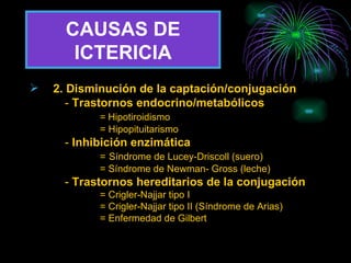 CAUSAS DE ICTERICIA 2.   Disminución de la captación/conjugación -  Trastornos endocrino/metabólicos =   Hipotiroidismo = Hipopituitarismo -  Inhibición enzimática =   Síndrome de Lucey-Driscoll (suero) = Síndrome de Newman- Gross (leche)  -  Trastornos hereditarios de la conjugación = Crigler-Najjar tipo I = Crigler-Najjar tipo II (Síndrome de Arias) = Enfermedad de Gilbert 
