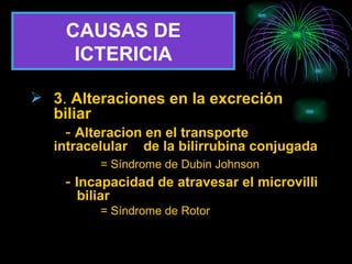 CAUSAS DE ICTERICIA 3 .  Alteraciones en la excreción biliar -  Alteracion en el transporte intracelular    de la bilirrubina conjugada = Síndrome de Dubin Johnson -  Incapacidad de atravesar el microvilli    biliar = Síndrome de Rotor 