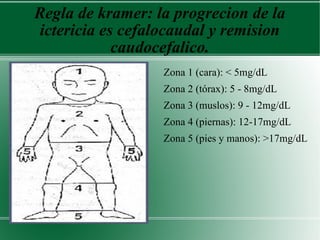 Regla de kramer: la progrecion de la ictericia es cefalocaudal y remision caudocefalico. Zona 1 (cara): < 5mg/dL Zona 2 (tórax): 5 - 8mg/dL Zona 3 (muslos): 9 - 12mg/dL Zona 4 (piernas): 12-17mg/dL Zona 5 (pies y manos): >17mg/dL 