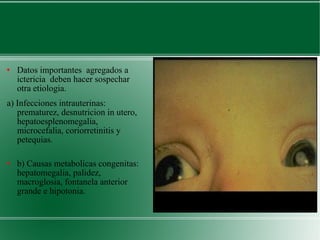 Datos importantes  agregados a ictericia  deben hacer sospechar otra etiologia. a) Infecciones intrauterinas: prematurez, desnutricion in utero, hepatoesplenomegalia, microcefalia, coriorretinitis y petequias.  b) Causas metabolicas congenitas: hepatomegalia, palidez, macroglosia, fontanela anterior grande e hipotonia. 