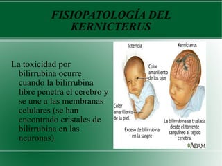 FISIOPATOLOGÍA DEL KERNICTERUS La toxicidad por bilirrubina ocurre cuando la bilirrubina libre penetra el cerebro y se une a las membranas celulares (se han encontrado cristales de bilirrubina en las neuronas). 