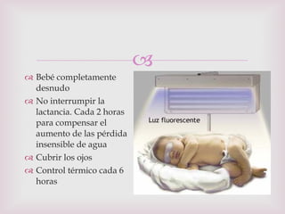Bebé completamente desnudo No interrumpir la lactancia. Cada 2 horas para compensar el aumento de las pérdida insensible de agua Cubrir los ojos Control térmico cada 6 horas 