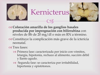 Coloración amarilla de los ganglios basales producida por impregnación con bilirrubina  con niveles de Bb de 20 mg/dl o más en RN a término. Constituye la complicación más grave de la ictericia neonatal.  Tres fases: Primera fase: caracterizada por inicio con vómitos, letargia, hipotonía, rechazo al alimento, succión débil y llanto agudo. Segunda fase: se caracteriza por irritabilidad, hipertonía y opistótonos. Kernicterus 