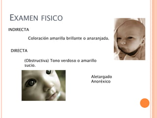 EXAMEN FISICO
INDIRECTA
Coloración amarilla brillante o anaranjada.
DIRECTA
(Obstructiva) Tono verdoso o amarillo
sucio.
Aletargado
Anoréxico

 