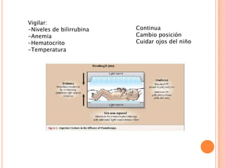 Vigilar:
-Niveles de bilirrubina
-Anemia
-Hematocrito
-Temperatura

Continua
Cambio posición
Cuidar ojos del niño

 