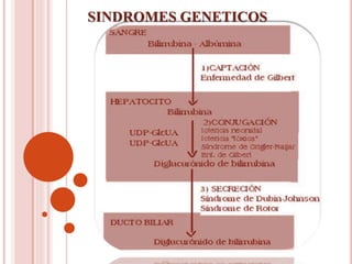 SINDROMES GENETICOS
 