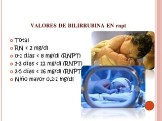  Total
 RN < 2 mg/dl
 0-1 días < 8 mg/dl (RNPT)
 1-2 días < 12 mg/dl (RNPT)
 2-5 días < 16 mg/dl (RNPT)
 Niño mayor 0,2-1 mg/dl
 