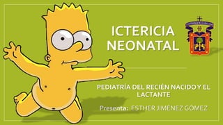 ICTERICIA
NEONATAL
PEDIATRÍA DEL RECIÉN NACIDOY EL
LACTANTE
Presenta: ESTHER JIMÉNEZ GÓMEZ
 