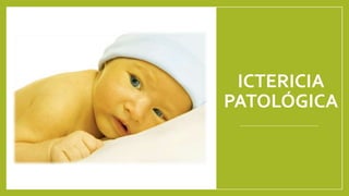 ICTERICIA
PATOLÓGICA
 