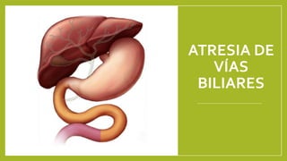 ATRESIA DE
VÍAS
BILIARES
 