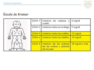 Kramer Test Ictericia neonatal | PDF
