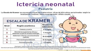 Diagnostico
Antecendentes
familiares
Inicio de la ictericia
Antecedentes
maternos
En toda ictericia patológica interesa valorar El tinte ictérico no sólo está presente en la piel y conjuntivas
Pediatr Integral 2019; XXIII (3): 147–153
 