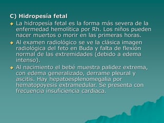 C) Hidropesía fetal
 La hidropesía fetal es la forma más severa de la
enfermedad hemolítica por Rh. Los niños pueden
nacer muertos o morir en las primeras horas.
 Al examen radiológico se ve la clásica imagen
radiológica del feto en Buda y falta de flexión
normal de las extremidades (debido a edema
intenso).
 Al nacimiento el bebé muestra palidez extrema,
con edema generalizado, derrame pleural y
ascitis. Hay hepatoesplenomegalia por
hematopoyesis extramedular. Se presenta con
frecuencia insuficiencia cardiaca.
 