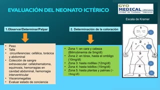 EVALUACIÓN DEL NEONATO ICTÉRICO
1.Observar/Determinar/Palpar 2. Determinación de la coloración
• Peso
• Talla
• circunferencias: cefálica, torácica
y abdominal
• Colección de sangre
extravascular: cefalohematoma,
equimosis, hemorragias en
cavidad abdominal, hemorragia
interventricular
• Visceromegalias
• Evaluar estado de conciencia
• Zona 1: en cara y cabeza
(Bilirrubinemia de 5mg/dl)
• Zona 2: en tórax, hasta el ombligo
(10mg/dl)
• Zona 3: hasta rodillas (12mg/dl)
• Zona 4: hasta tobillos (15mg/dl)
• Zona 5: hasta plantas y palmas (>
18mg/dl)
Escala de Kramer
 