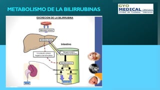 METABOLISMO DE LA BILIRRUBINAS
 
