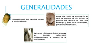 GENERALIDADES 
Fenómeno clínico muy frecuente durante 
el periodo neonatal 
Causa más común de reinternación en 
salas de cuidados de RN durante las 
primeras dos semanas de vida, para 
fototerapia y, en no pocas oportunidades, 
para exanguinotransfusión. 
La ictericia clínica generalmente progresa 
en dirección cefalocaudal 
proporcionalmente al aumento de la 
bilirrubinemia 
 