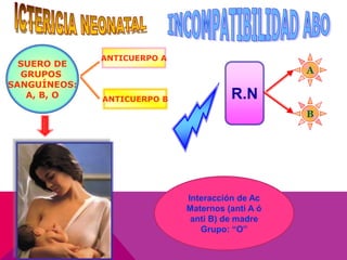 SUERO DE
GRUPOS
SANGUÍNEOS:
A, B, O
ANTICUERPO A
ANTICUERPO B R.N
A
B
Interacción de Ac
Maternos (anti A ó
anti B) de madre
Grupo: “O”
 