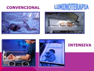 CONVENCIONAL
INTENSIVA
 