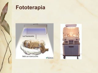 Fototerapia 