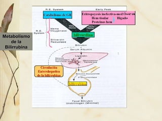 Metabolismo de la Bilirrubina 