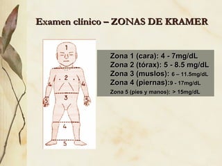 Examen clínico – ZONAS DE KRAMER
Examen clínico – ZONAS DE KRAMER
Zona 1 (cara): 4 - 7mg/dL
Zona 1 (cara): 4 - 7mg/dL
Zona 2 (tórax): 5 - 8.5 mg/dL
Zona 2 (tórax): 5 - 8.5 mg/dL
Zona 3 (muslos):
Zona 3 (muslos): 6 – 11.5mg/dL
6 – 11.5mg/dL
Zona 4 (piernas):
Zona 4 (piernas):9 - 17mg/dL
9 - 17mg/dL
Zona 5 (pies y manos):
Zona 5 (pies y manos): > 15mg/dL
> 15mg/dL
 