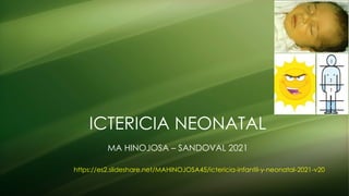 ICTERICIA NEONATAL
MA HINOJOSA – SANDOVAL 2021
https://es2.slideshare.net/MAHINOJOSA45/ictericia-infantil-y-neonatal-2021-v20
 