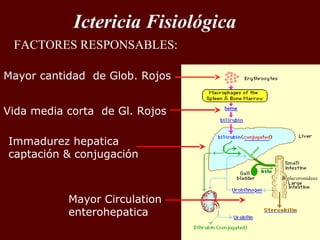 Ictericia Fisiológica
 FACTORES RESPONSABLES:

Mayor cantidad de Glob. Rojos


Vida media corta de Gl. Rojos

Immadurez hepatica
captación & conjugación

                                    B-glucoronidasa



           Mayor Circulation
           enterohepatica
 