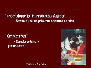 “Encefalopatía Bilirrubinica Aguda”
     - Sintomas en las primeras semanas de vida



“Kernicterus”
     - Secuela crónica y
 permanente




              2004 AAP Guías
 