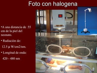 Foto con halogena
                         Dan 6 to 12 µW/cm2 per nm



•A una distancia de 55
cm de la piel del
neonato.
• Radiación de:
12.5 µ W/cm2/nm.
• Longitud de onda:
 420 - 480 nm
 