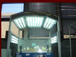 Fototerapia estandard,8 fluorescentes
 Dan 6 to 12 µW/cm2 per nm
 