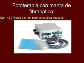 Fototerapia con manta de
                 ,

               fibraoptica
Dan 45 µW/cm2 per nm, pero en un área pequeña
 