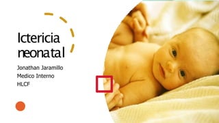 Ictericia
neonatal
Jonathan Jaramillo
Medico Interno
HLCF
 